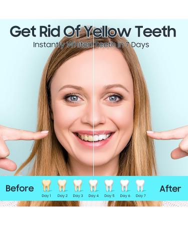 Teeth Whitening Strips - Sensitive White Strips for Clean, Safely Whitened Teeth | Stains Remover for Coffee, Wine, Tobacco (28 PCS) - Buy Online on GoSupps.com