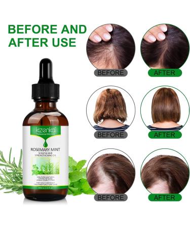 Rosemary Mint Growth Oil | Revitalize & Strengthen Hair & Scalp | Natural Hair Oil for Healthy Growth - Buy Online on GoSupps.com