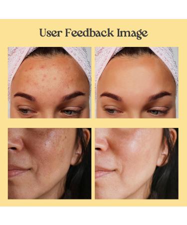 Neatique Vitamin C Clay Mask - 7.05 Oz Turmeric Facial Mask for Deep Cleansing Detox and Skin Tone Repair - Boost Complexion & Reduce Dark Spots - Buy Online on GoSupps.com