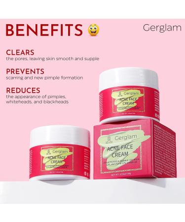 Acne Face Cream with Salicylic Acid | Cystic Acne Treatment for Face & Body | Anti-Acne Skincare for Teens & Adults | 3.53 OZ - Buy Online on GoSupps.com