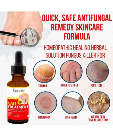 Natural Nail & Toenail Repair Treatment - Extra Strength Drops for Nails, Athlete's Feet, Jock Itch, Ringworm & Skin Rash - USA Made - Buy Online on GoSupps.com