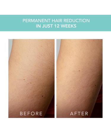 FOREO Peach 2 Go IPL Hair Removal Device - Travel-Friendly Painless Laser Hair Removal for Body & Face Skin Cooling & Silicone Shield - Customizable Arctic Blue - Buy Online on GoSupps.com