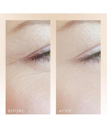 LumaGlow Red & Blue LED Light Therapy by Project E Beauty | Anti-Aging & Anti-Acne | Fine Lines & Wrinkle Scars | Calms Inflammation & Sensitive Skin | Handheld Device | Spa & Home Use - Buy Online on GoSupps.com