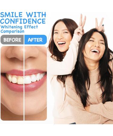 Xumann 10PCS Teeth Whitening Gel 3ml Teeth Whitening Gel Syringes Bleaching Gel Teeth Whitener Gels Refills Kit - Buy Online on GoSupps.com