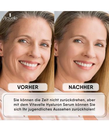 yaluron Serum hochdosiert - Aloe Vera Serum f r Gesicht - Anti Aging Feuchtigkeitsserum f r glatte weiche ebenm ßige - Buy Online on GoSupps.com
