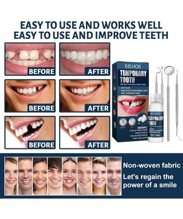 5-Pack Temporary Tooth Repair Kit with Mouth Mirror Family Use at Home - Multi-Colored | International Shipping - Buy Online on GoSupps.com