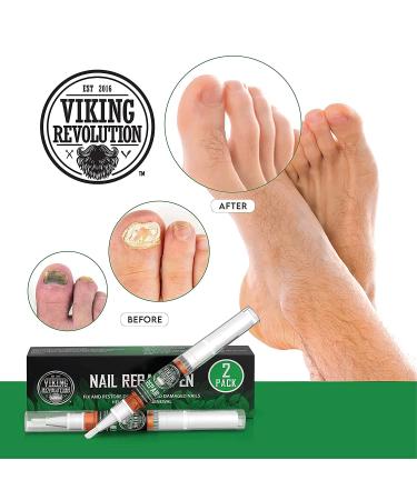 Nail Repair Gel Pen - Antifungal Treatment for Toe and Finger Nails - Strengthens and Repairs Brittle Nails - 2 Pens - Buy Online on GoSupps.com