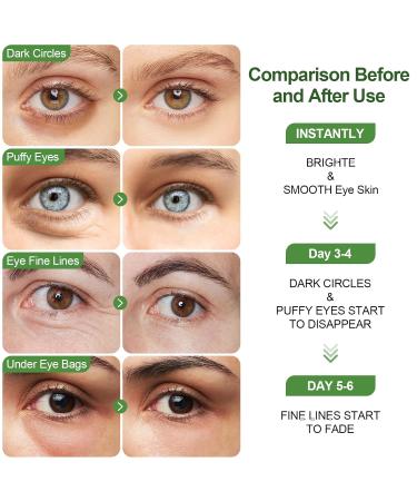 Aloe Vera Eye Pads - 60pcs Collagen & Hyaluronic Acid Masks for Dark Circles Puffiness & Wrinkles - Hydrogel Eye Patches for Tear Bags - Buy Online on GoSupps.com