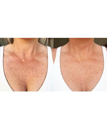 CIRCCELL LUCENT Brightening Moisturizer Radiance-Boosting Face Lotion for Even Skin Tone | Hydrating & Anti-Aging Formula | Helps Improve Skin Clarity & Texture | Lightweight & Fast-Absorbing - Buy Online on GoSupps.com