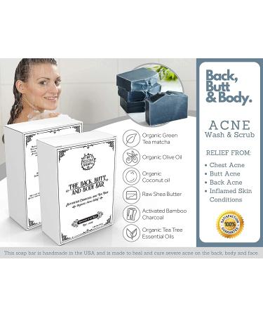 Tea Tree Activated Charcoal Soap Bar for Acne, Psoriasis, and Eczema Relief - Natural Alternative to Benzoyl Peroxide - The Medicinal Soap Co - Buy Online on GoSupps.com