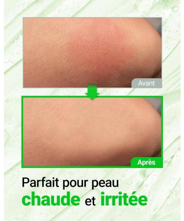 SNP Aloe Vera Intensive Soothing Gel Hydratant Polyvalent avec Extrait de Feuilles d Aloe Vera pour le Visage le Corps les Cheveux et Tous Types de Peaux pour Apaiser 300 g - Buy Online on GoSupps.com