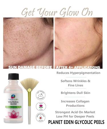 Glycolic Acid Peel 40% Full Strength Chemical Exfoliant Alpha Hydroxy Acid AHA Peel Deep Skin Resurfacing At-Home Facial Peel for Smooth Texture & Radiant Glow Anti-Aging Exfoliation Treatment 1 Count (Pack of 1) - Buy Online on GoSupps.com