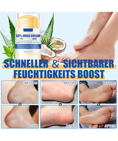 MrCuvaryas 60 Urea Cream 40 g foot care for very dry feet moisturizing and anticracking moisturizing and softening the feet cream for cracked feet heels and elbows - Buy Online on GoSupps.com