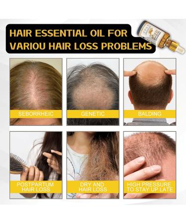Trendyfave Ginseng Hair Growth Serum Hair Growth Oil Anti Hair Loss Essence Hair Oil for Dry Damaged Hair Nourishing Scalp Oil for Hair Growth Hair Serum for Hair Growth for Fast Hair Growth - Buy Online on GoSupps.com