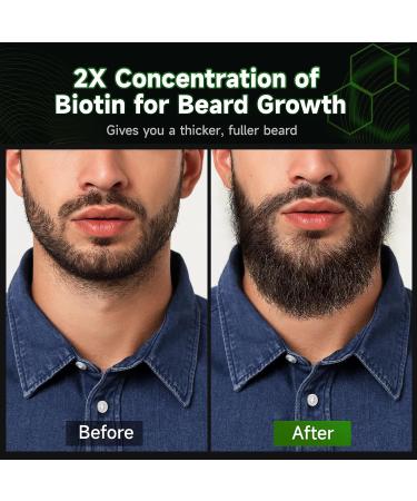 Beard Growth Oil - 2X Biotin Conditioner for Men | Softens Moisturizes & Strengthens Mustaches - Natural Argan & Jojoba Oil - 2 Fl. Oz - Sandalwood Scent - Buy Online on GoSupps.com