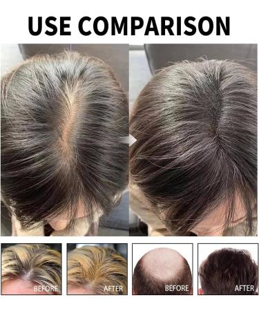 MagiForeign Hair growth serum rosemary oil accelerates hair growth with rosemary for hair growth oil massage the scalp to care for the hair prevents hair loss for men and women 60 ml - Buy Online on GoSupps.com