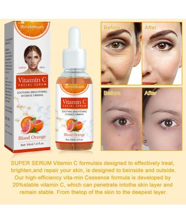 Bisienya Vit C Serum Vitamin C Face Serum for Women And Men Anti Aging Serum for Face Facial Serum for All Skin Types Hydrating Repair Brightening Facial(30ml) - Buy Online on GoSupps.com