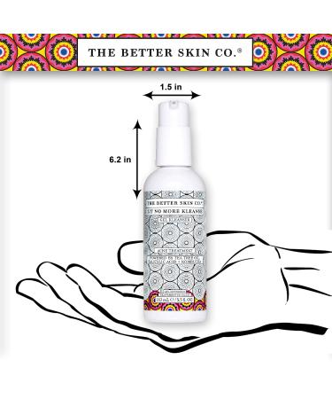 Zit No More Kleanse Facial Gel Cleanser - Treat Acne Prone Skin | The Better Skin Co. 5.5 Fl Oz - International Shipping Available - Buy Online on GoSupps.com