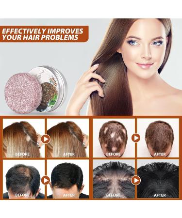 Hira Darkening Shampoo Bar 55G - Organic Black Soap for Gray Hair - Unisex | Pack of 2 - Buy Online on GoSupps.com