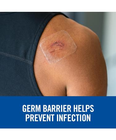 Nexcare Tegaderm Transparent Dressing H1626-06-CA Waterproof 4 in x 4 3/4 in (10 cm x 12 cm) 6/Pack 4 in 6 Count - Buy Online on GoSupps.com