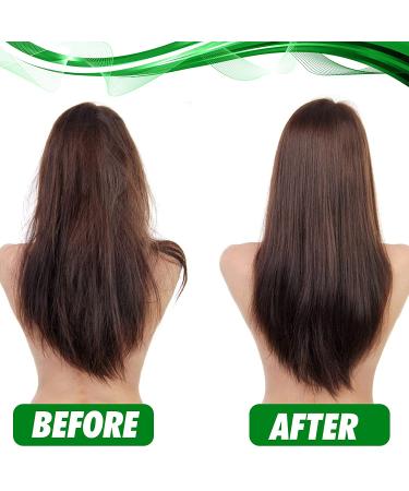 Tea Tree Oil Shampoo & Conditioner Set | Anti-Dandruff, Sulfate & Paraben Free, Itchy Scalp Treatment for Men & Women - 2 x 16.9 Fl Oz - Buy Online on GoSupps.com