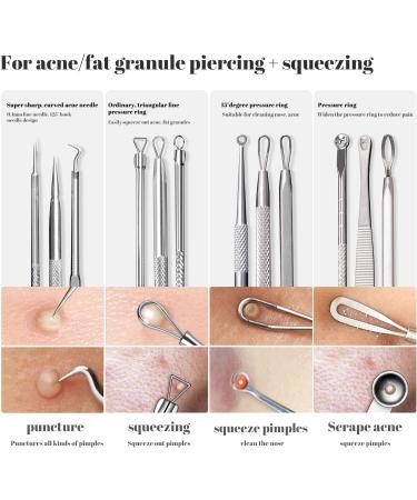 Cptots Blackhead Remover Tools 20 Pcs Kit - Skin Care Acne Extractor Set with Metal Case - Buy Online on GoSupps.com