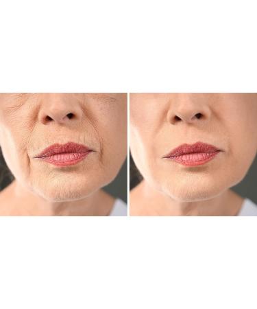 RADICAL CHANGE - Straightener Plus - Anti-Eye Cream Express Lines Removes Eye Bags Quickly - Tested Effectiveness - Buy Online on GoSupps.com