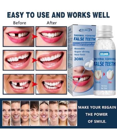 Temporary Tooth Filling Kit for Missing or Broken Tooth Repair | Moldable False Teeth Replacement Solution - Buy Online on GoSupps.com