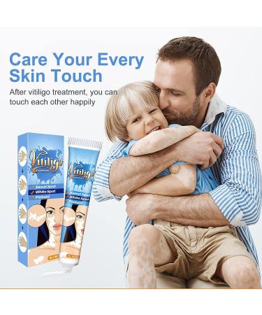 Vitiligo Cream for Skin Treatment and Pigmentation Care - Buy Online on GoSupps.com