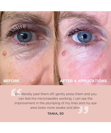 Vice Reversa Eye Rejuvenator - Hyaluronic Acid Under Eye Patches for Hydration & Brightening - MicroCrystal Skincare (12 Pairs) - Buy Online on GoSupps.com