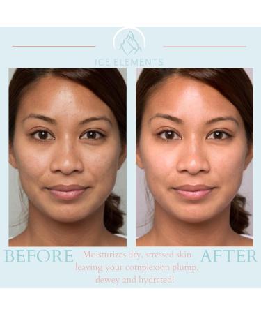 2 Minute Miracle Face Moisturizer - Ice Elements with Tri-Moisture Cryo Complex | Fast International Shipping - Buy Online on GoSupps.com