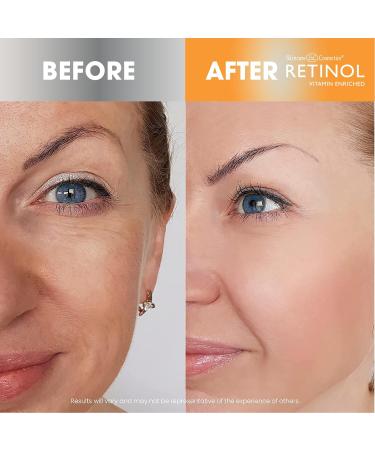 Retinol + Vitamin C Face Serum - Anti-Aging Evens Skin Tone Reduces Fine Lines & Dark Spots - 1 FL. Oz - Buy Online on GoSupps.com