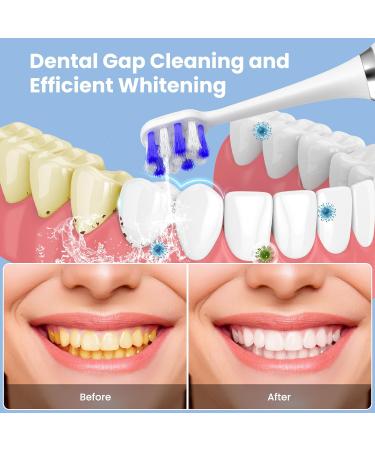 Buy XY1 Toothbrush Replacement Heads - Compatible Affordable & Eco-Friendly Options for Your Oral Care Needs - Buy Online on GoSupps.com
