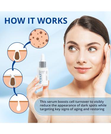 ABERA Retinol Serum for Face - Anti-Aging Dark Spot Remover & Melasma Treatment (0.67 Fl Oz) - Brightening Formula for Glowing Skin - Buy Online on GoSupps.com