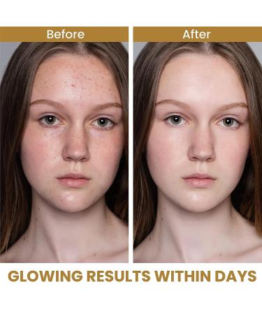 Natures Journey Vitamin C Serum with Hyaluronic Acid - Dark Spot Corrector & Anti-Aging Formula (1 oz) - Buy Online on GoSupps.com