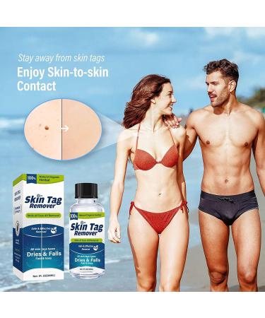 Zacurate Skin Tag Remover & Wart Mole Verruca Treatment Lotion - Fast-Acting Blue Formula - 30ML (Pack of 1) - Buy Online on GoSupps.com