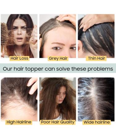 S-noilite Hair Toppers with Fringe Human Hair for Thinning Hair Women Real Hair Topper Hair Piece Clip In Hair Extensions 100% Remy Real Human Hair 27g(#12/613 Golden Brown and Bleach Blonde 6 Inch) 6 Inch Golden Brown and Bleach Blonde - Buy Online on GoSupps.com