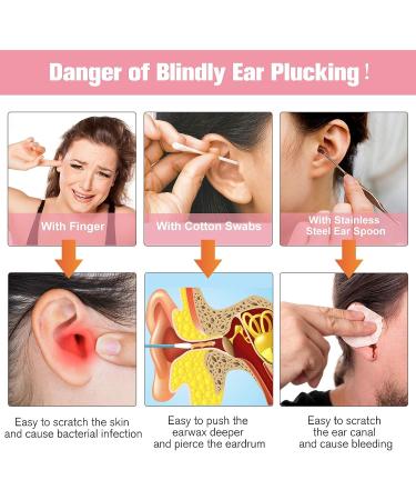 Wireless Otoscope with Camera for Ear Wax Removal - 1080P WiFi Ear Cleaner for iOS Android - Visual Ear Endoscope for Adults, Kids & Pets - Pink - Buy Online on GoSupps.com