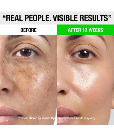 Dark Spot Clarity Oil Serum with Vitamin C for Uneven Tone & Post-Acne Marks Korean Vegan Skincare with Ginseng Berry, Licorice Root, Arbutin & Tranexamic Acid by BYRANA 1 oz - Buy Online on GoSupps.com