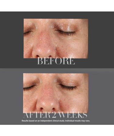 Kate Somerville KateCeuticals Resurfacing Overnight Peel - Clinic-Grade Anti-Aging Face Peel 1 Fl Oz | Shop Internationally - Buy Online on GoSupps.com