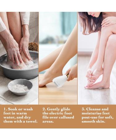 BarberBoss Electric Foot File Hard Skin Remover Professional Pedicure Set for Feet Foot Files for Hard Skin Premium Callus Remover for Feet Feet Hard Skin Remover Electric Waterproof QR-5082 Gold/White - Buy Online on GoSupps.com