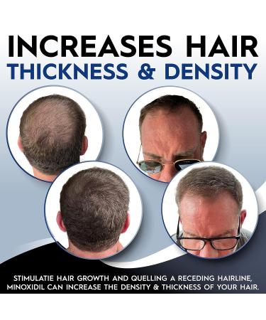 Minoxidil 5% Foam with Biotin for Men & Women - Lab Certified Hair Regrowth Treatment with Natural Growth Vitamins - 3 Month Supply - Buy Online on GoSupps.com