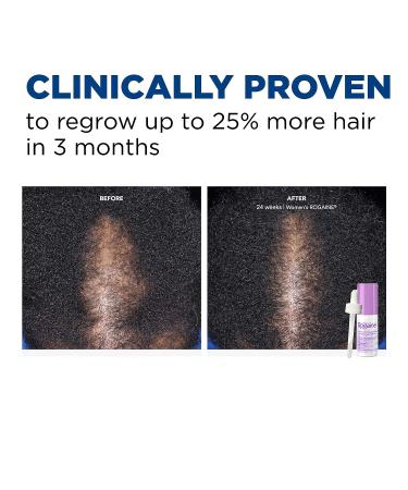 Women's Rogaine 2% Minoxidil Topical Solution - Hair Thinning and Loss Treatment for Regrowth - 3-Month Supply - Buy Online on GoSupps.com