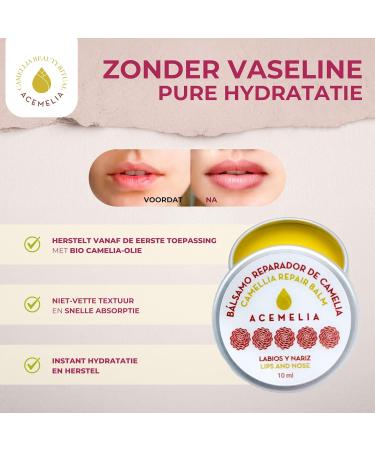 Camelia Cosmetiques SL ACEMELIA 2Pack Repairing Lip Balms 2 x 10 ml Nose and Lips Intense Recovery and Hydration for Dry and Cracked Lips Protection Against Cold and Wind Vegan - Buy Online on GoSupps.com
