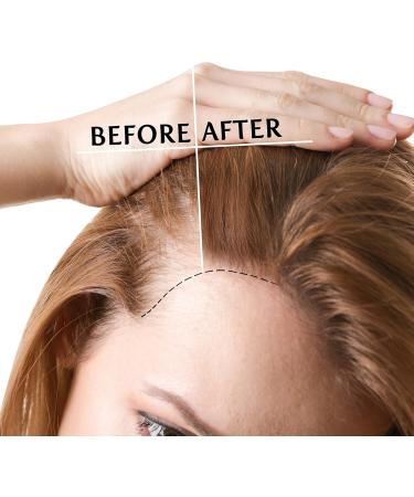 NORMADENSE Salon Vegan Hair Oil Strengthening Thickening hair oil Fortifying hair capsules for Normal to Thin-Looking Hair. Thicker Fuller Hair Serum with Argan Oil Biotin & Hair Vitamins - Buy Online on GoSupps.com