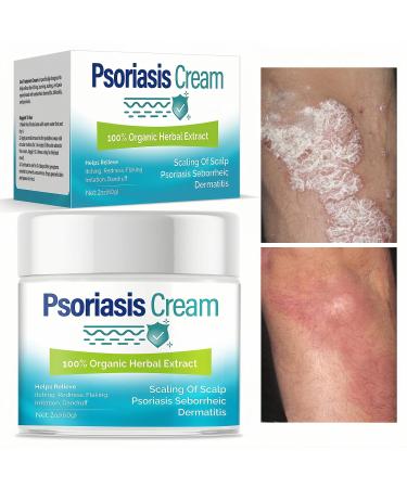 iTecFreely Psoriasis Cream Fast and Effective Scalp Treatment Relief Dry Scalp & Dandruff Eczema Treatment for Face and Body