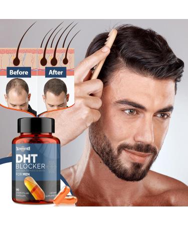 DHT Blocker for Men with Saw Palmetto & Biotin Hair Growth Formula in Liquid-Filled Capsules Hair Loss Supplements Hair Regrowth Vitamins Proprietary Herbal Blends - 90 Capsules 90 Count (Pack of 1) - Buy Online on GoSupps.com