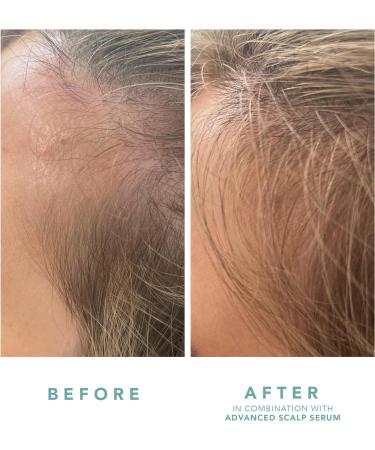 WE ARE PARADOXX Growth Scalp Serum with Trioplexx Technology - Stimulates Hair Follicles for Thicker, Healthier Hair - Natural Vegan Formula with Caffeine, Keratin, Biotin - 50ml - Buy Online on GoSupps.com