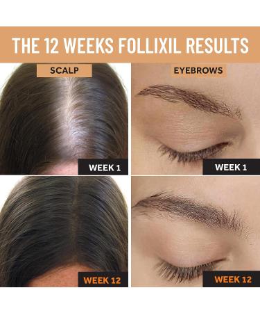 2% Minoxidil for Women with Extra Biotin, Capilia Longa, and Caffeine - 1 Month Supply - Hair and Eyebrows Growth Serum - Buy Online on GoSupps.com