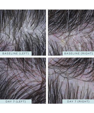 Ameliorate Soothing Scalp Essence 100ml | Lab6 Probiotic Lactic Acid | Dermatologically Tested Trichologist Approved - Buy Online on GoSupps.com